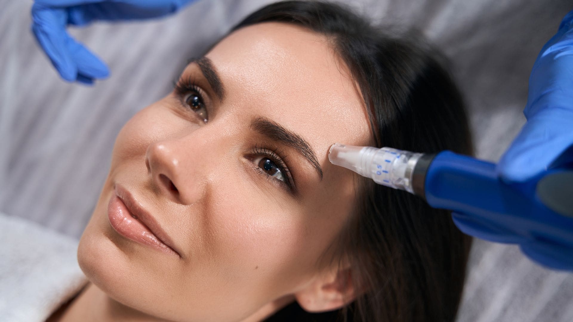 what is microneedling and who does microneedling near me?, microneedling+and+microdermabrasion2