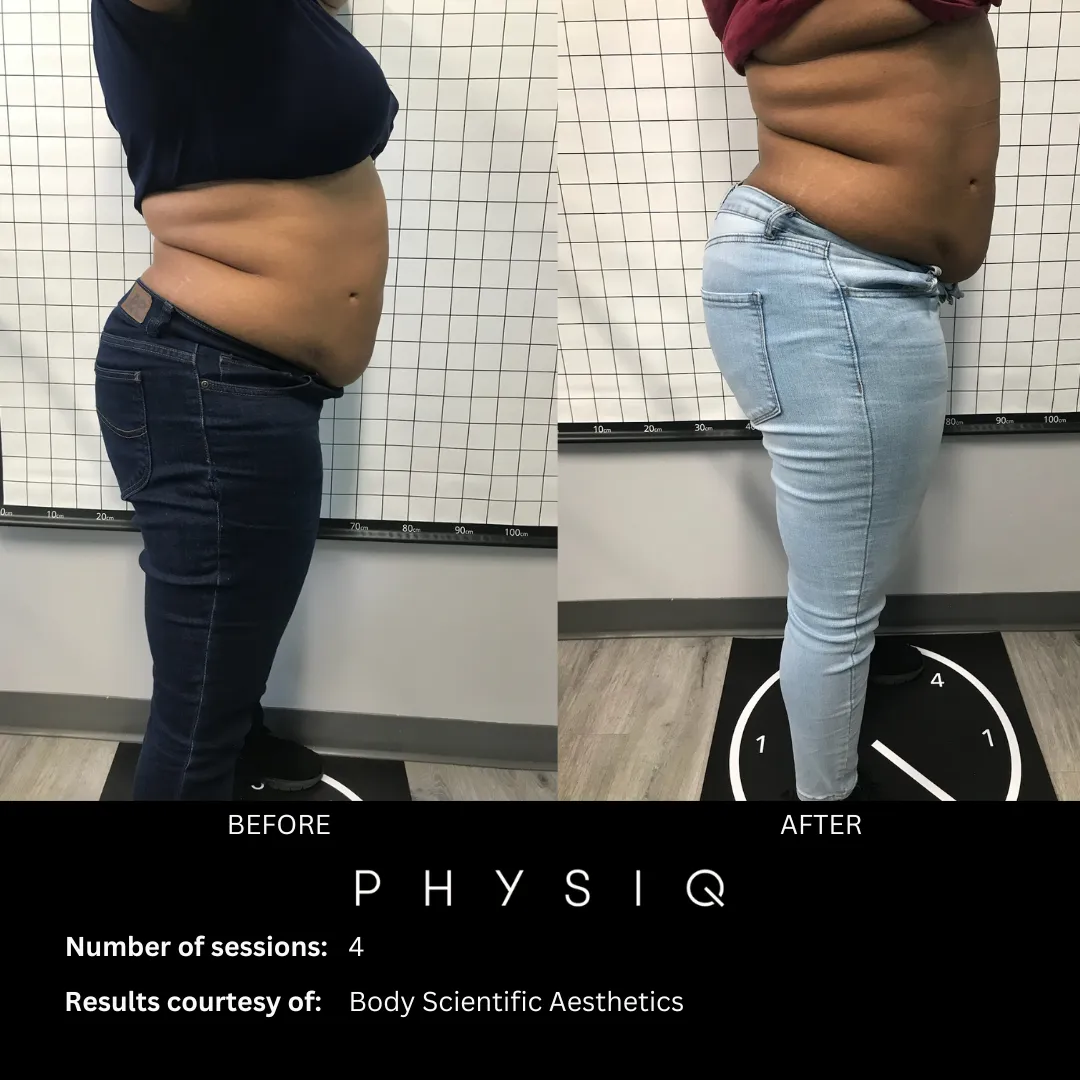Professional body contouring clinic in Timonium, Maryland