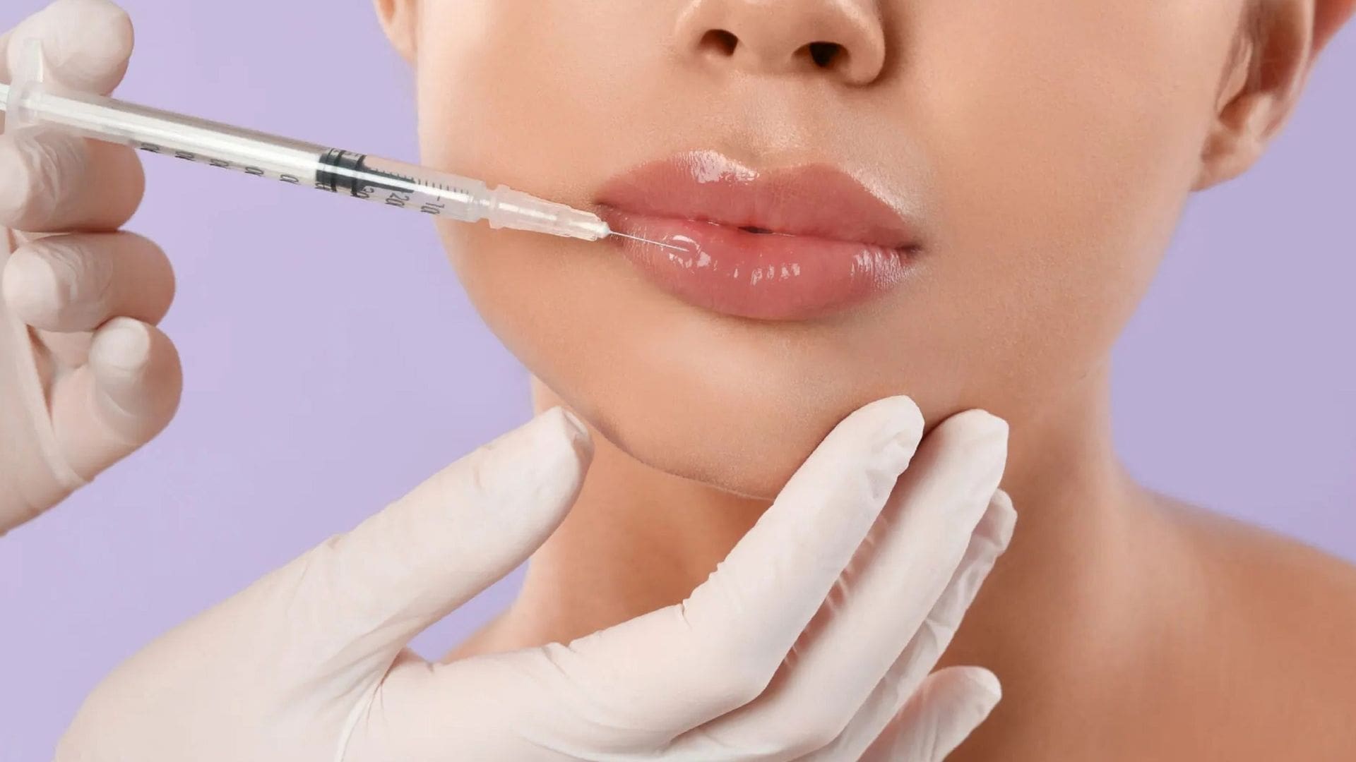 Close-up of a woman's lips receiving a hyaluronic acid filler injection, highlighting lip enhancement and aesthetic treatment at a medical spa.