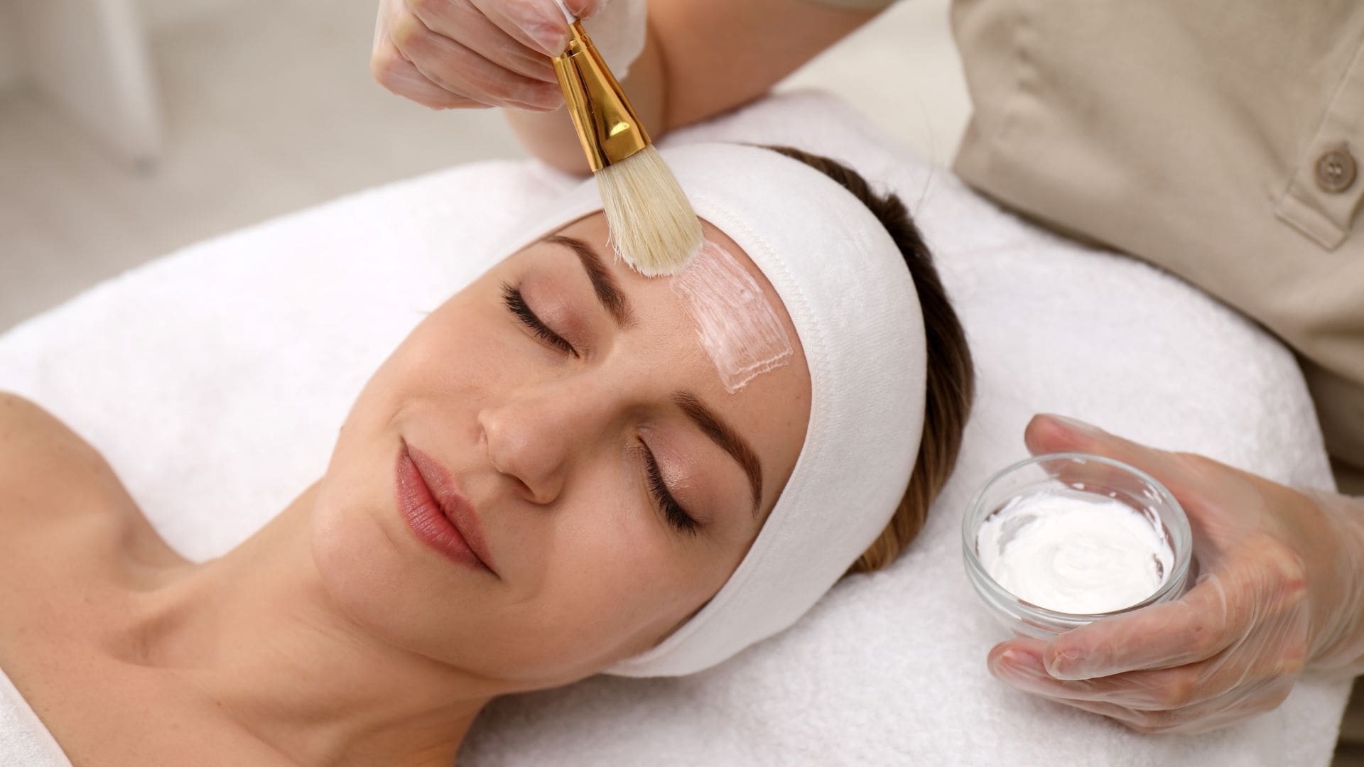 Woman receiving a chemical peel treatment, with a clinician applying a chemical solution to her forehead using a brush, in a clinical setting focused on skin rejuvenation.