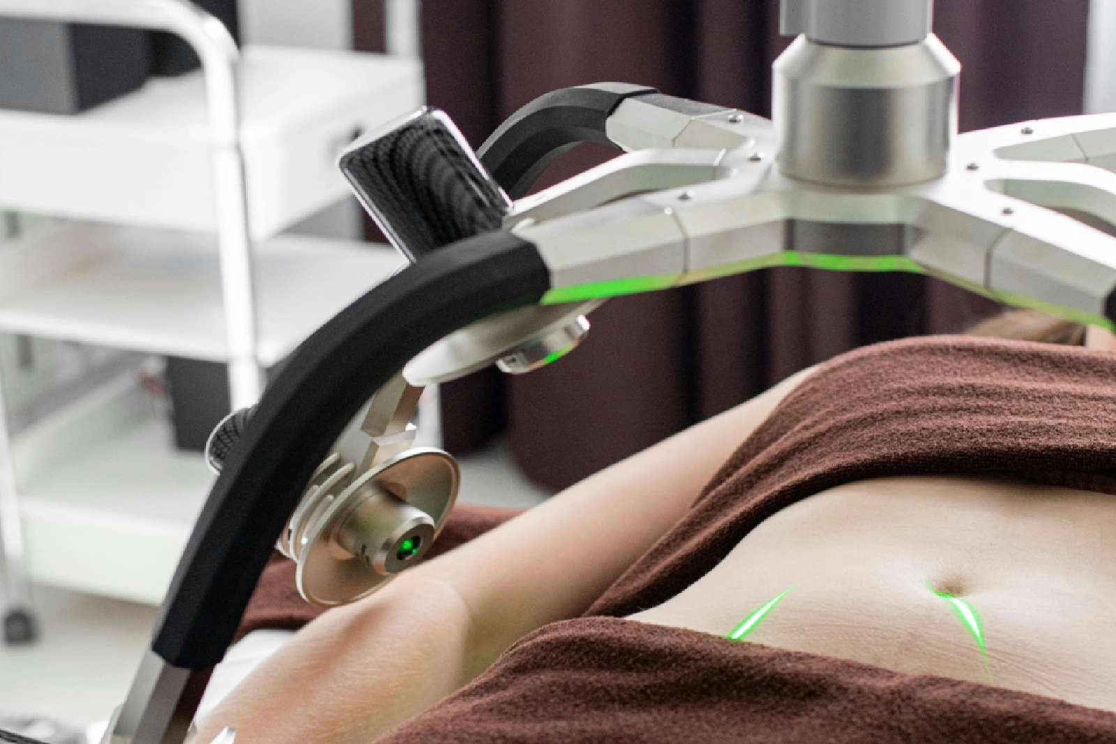Close-up of a person receiving acupuncture treatment.