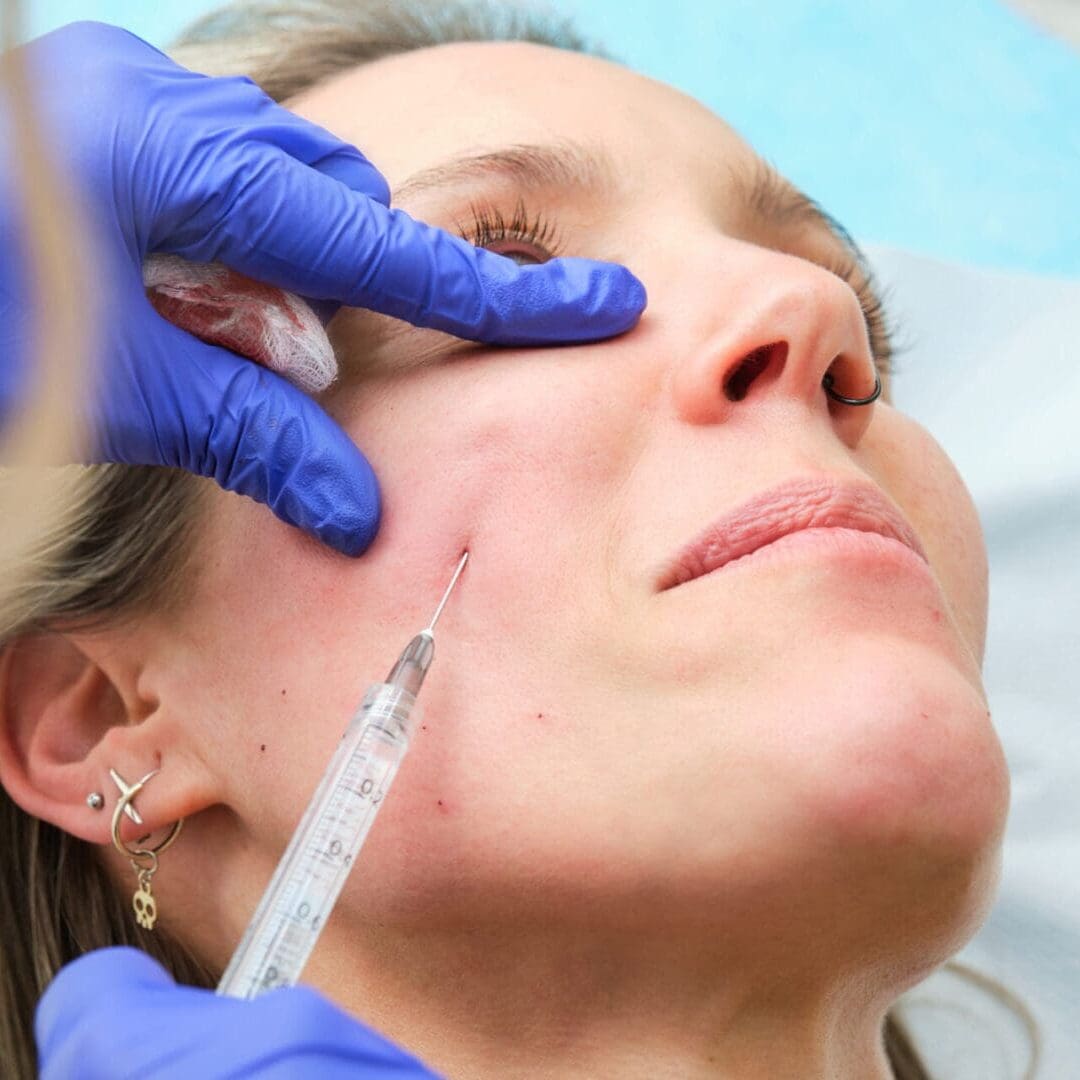 A woman receiving a cosmetic facial injection.
