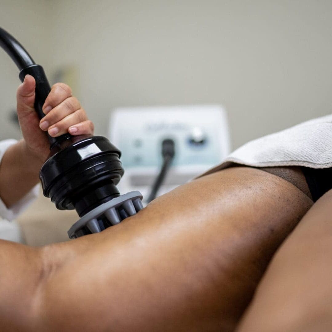 Advanced PHYSIQ body contouring technology in Pikesville