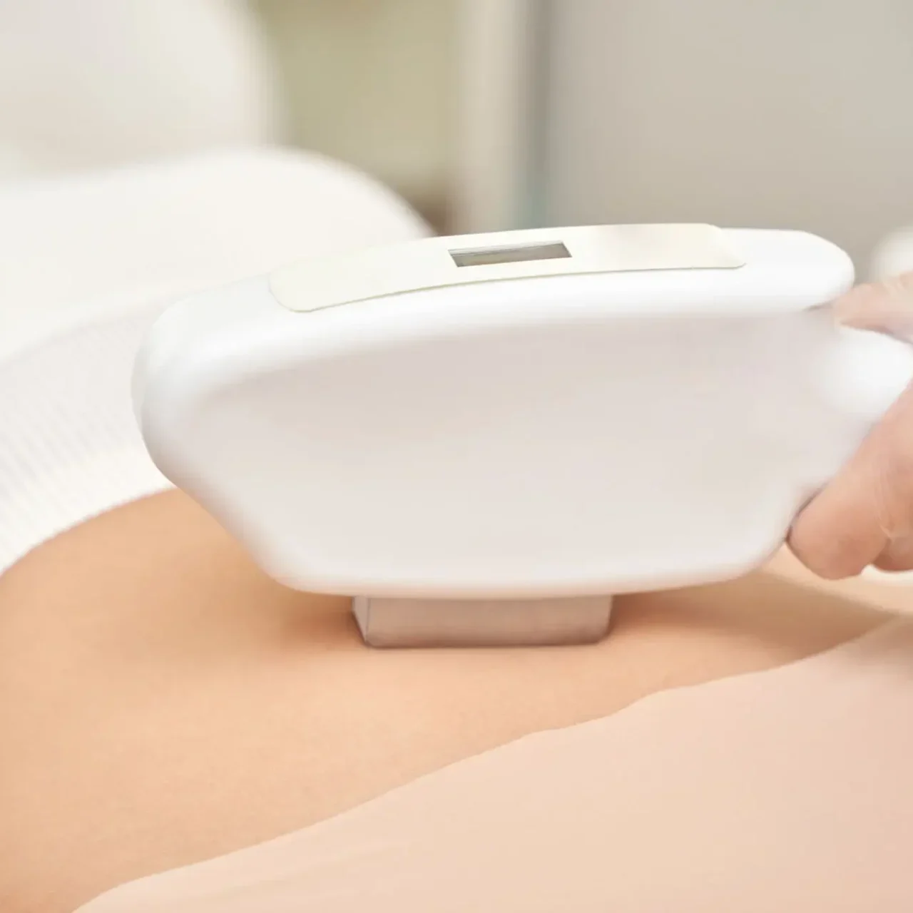 Close-up of a medical device on a patient's abdomen.